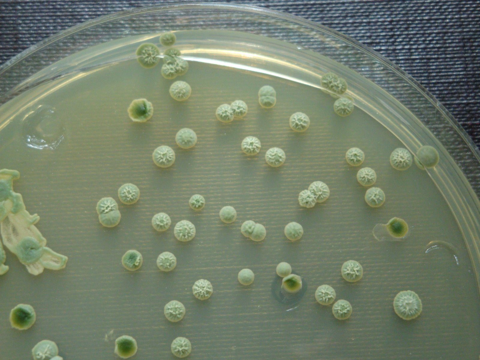 Brettanomyces